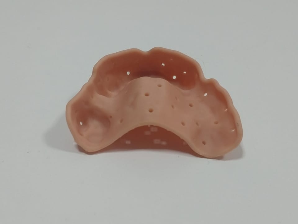 3D Printing Limburg | https://www.3dprintinglimburg.nl/files/afbeeldingen/portfolio/Dental18 Cropped.jpg